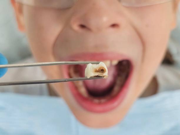 Emergency Dentist for Kids in UT